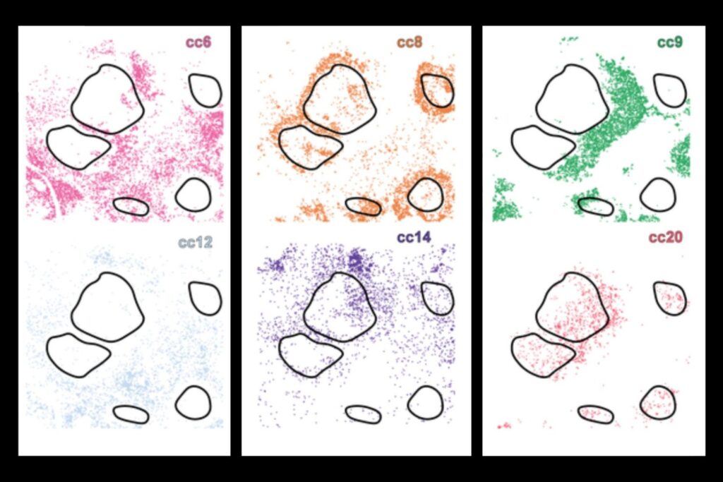 ai-tool-revolutionizes-cancer-treatment-with-precision-cell-mapping