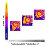 air-pollution-s-impact-on-heart-health-revealed-by-cardiac-mri-study