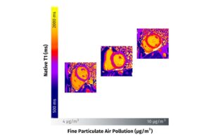 air-pollution-s-impact-on-heart-health-revealed-by-cardiac-mri-study