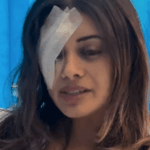 australia-faces-backlash-over-crackdown-on-protesters-amid-injuries-to-activist