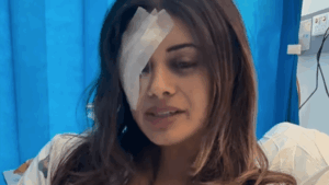 australia-faces-backlash-over-crackdown-on-protesters-amid-injuries-to-activist