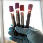 breakthrough-in-early-detection-of-type-2-diabetes-through-microrna