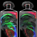 breakthrough-mri-technology-promises-first-comprehensive-brain-map
