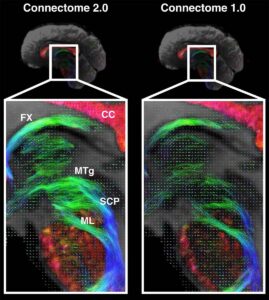 breakthrough-mri-technology-promises-first-comprehensive-brain-map