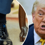 donald-trump-diagnosed-with-benign-chronic-venous-insufficiency