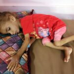 gaza-s-malnutrition-crisis-deepens-amidst-israel-iran-conflict