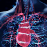 genetic-variants-linked-to-cardiomyopathy-risk-in-pediatric-cancer-survivors