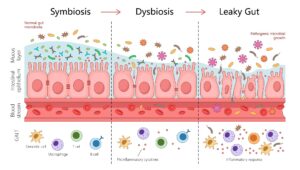 gut-health-and-heart-failure-unveiling-the-microbiome-connection