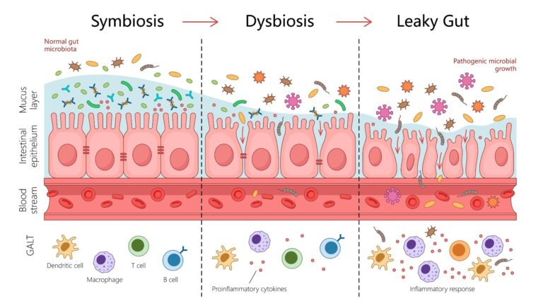 gut-health-and-heart-failure-unveiling-the-microbiome-connection
