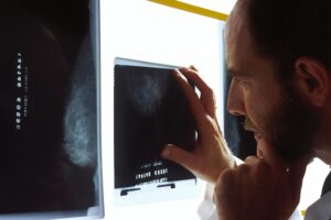 innovative-organ-chip-platform-enhances-chemotherapy-for-esophageal-cancer