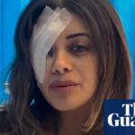 legal-action-considered-over-alleged-police-force-at-sydney-protest