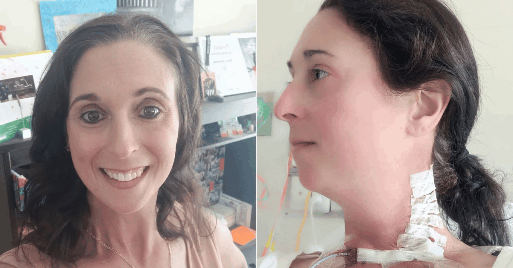misdiagnosed-when-thyroid-cancer-masquerades-as-migraines