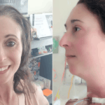misdiagnosed-when-thyroid-cancer-masquerades-as-migraines
