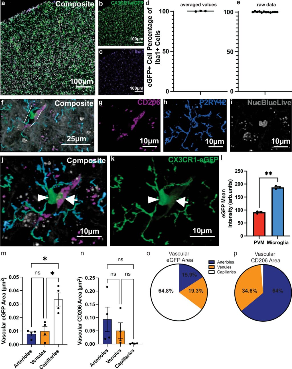 new-discovery-on-microglia-could-revolutionize-alzheimer-s-treatment