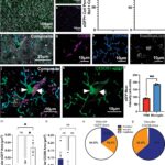 new-discovery-on-microglia-could-revolutionize-alzheimer-s-treatment