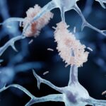 new-study-reveals-over-200-misfolded-proteins-linked-to-alzheimer-s-and-dementia