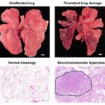 obesity-influences-long-term-effects-of-covid-19-in-primate-study