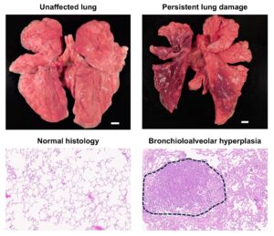 obesity-influences-long-term-effects-of-covid-19-in-primate-study