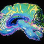 postoperative-delirium-a-preventable-yet-high-impact-surgical-complication