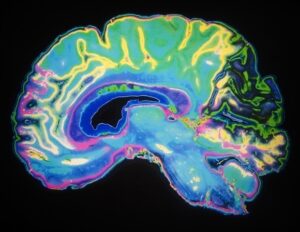 postoperative-delirium-a-preventable-yet-high-impact-surgical-complication