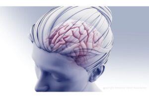 u-s-news-enhances-stroke-hospital-ratings-with-new-heart-association-measure