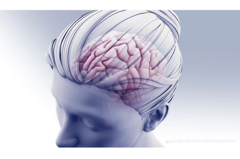 u-s-news-enhances-stroke-hospital-ratings-with-new-heart-association-measure