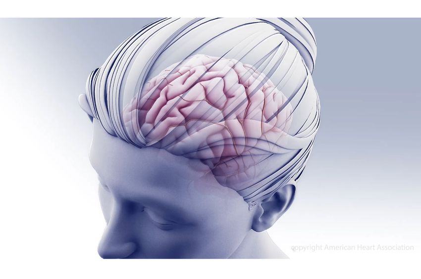 u-s-news-enhances-stroke-hospital-ratings-with-new-heart-association-measure