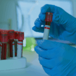 uk-to-align-with-eu-standards-for-high-risk-diagnostic-devices