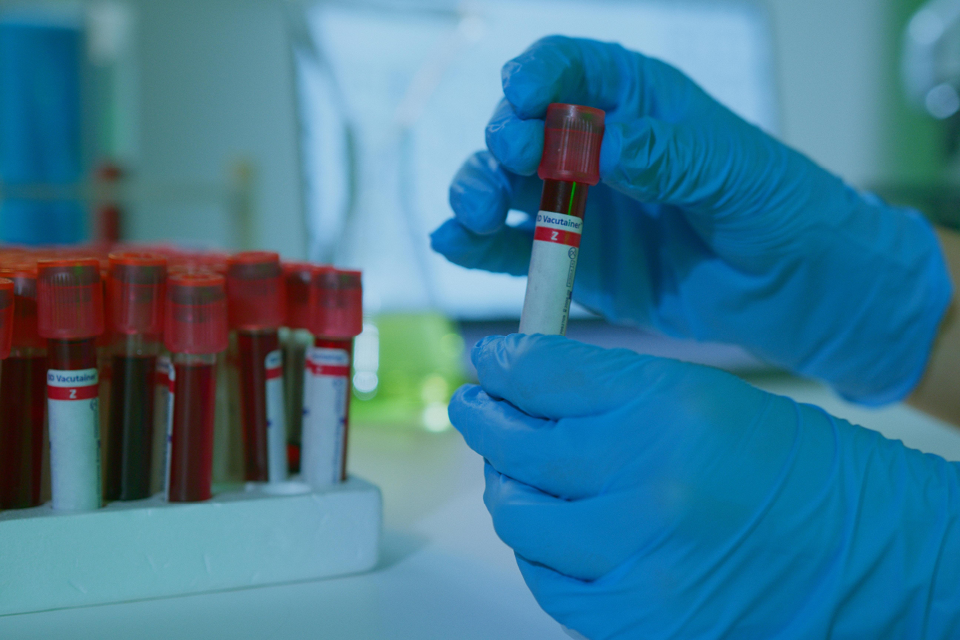 uk-to-align-with-eu-standards-for-high-risk-diagnostic-devices