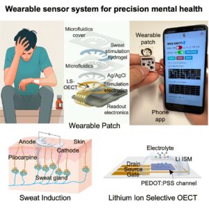 wearable-sensor-revolutionizes-lithium-monitoring-for-bipolar-disorder-patients