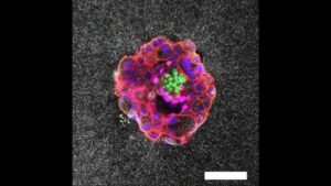 breakthrough-3d-imaging-captures-human-embryo-implantation