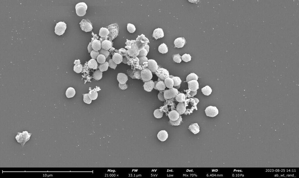 breakthrough-in-methane-tracking-scientists-hack-microbes-for-environmental-insights