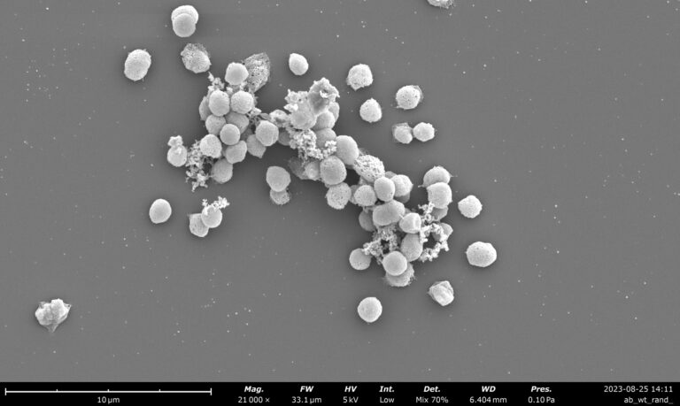 breakthrough-in-methane-tracking-scientists-hack-microbes-for-environmental-insights