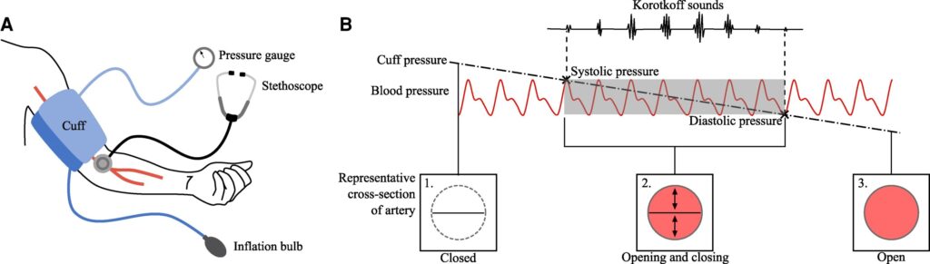 how-inaccurate-blood-pressure-readings-could-affect-health-outcomes