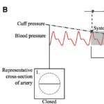 how-inaccurate-blood-pressure-readings-could-affect-health-outcomes