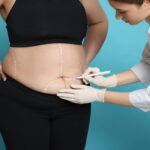 long-term-vitamin-deficiencies-plague-bariatric-surgery-patients