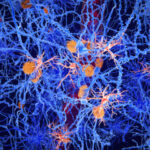 new-study-links-depression-to-altered-brain-cells-paving-way-for-innovative-treatments