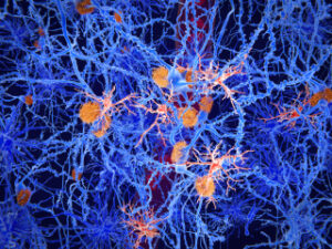 new-study-links-depression-to-altered-brain-cells-paving-way-for-innovative-treatments