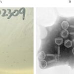 novel-bacteriophage-offers-hope-against-antibiotic-resistant-infections