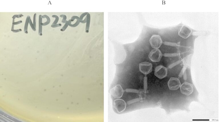 novel-bacteriophage-offers-hope-against-antibiotic-resistant-infections