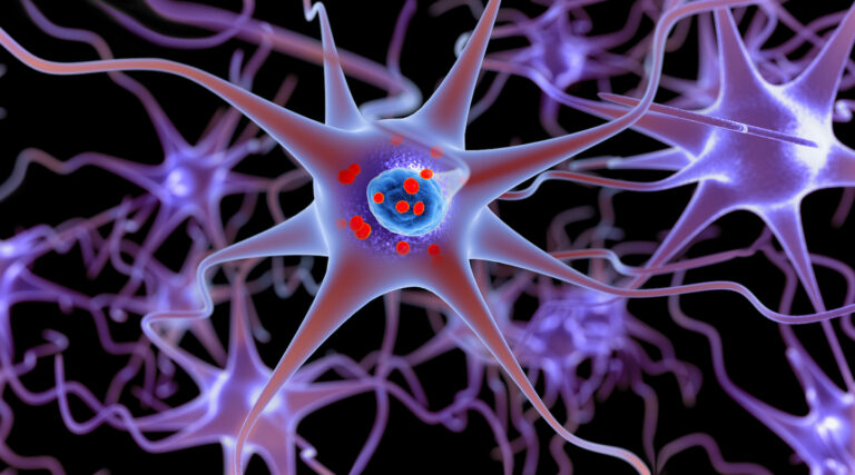 study-reveals-hypoxia-s-potential-in-reversing-parkinson-s-brain-damage