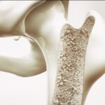 young-blood-serum-requires-bone-marrow-for-effective-skin-rejuvenation