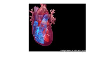 american-heart-association-launches-initiative-to-improve-heart-failure-care