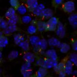 discovery-of-genetic-switch-for-primary-cilia-formation-offers-new-hope-for-ciliopathy-treatments