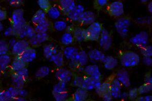 discovery-of-genetic-switch-for-primary-cilia-formation-offers-new-hope-for-ciliopathy-treatments