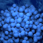 dispersed-glioblastoma-cells-a-new-frontier-in-cancer-aggressiveness