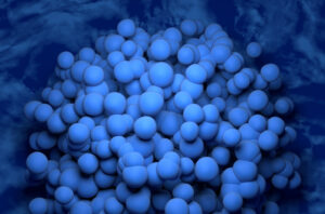 dispersed-glioblastoma-cells-a-new-frontier-in-cancer-aggressiveness