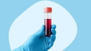 exploring-the-quest-for-a-cure-type-1-diabetes-breakthroughs