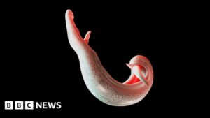 global-initiative-targets-schistosomiasis-affects-millions-in-africa