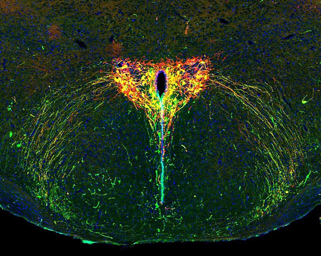 how-parental-separation-influences-brain-development-new-insights-from-oxytocin-research